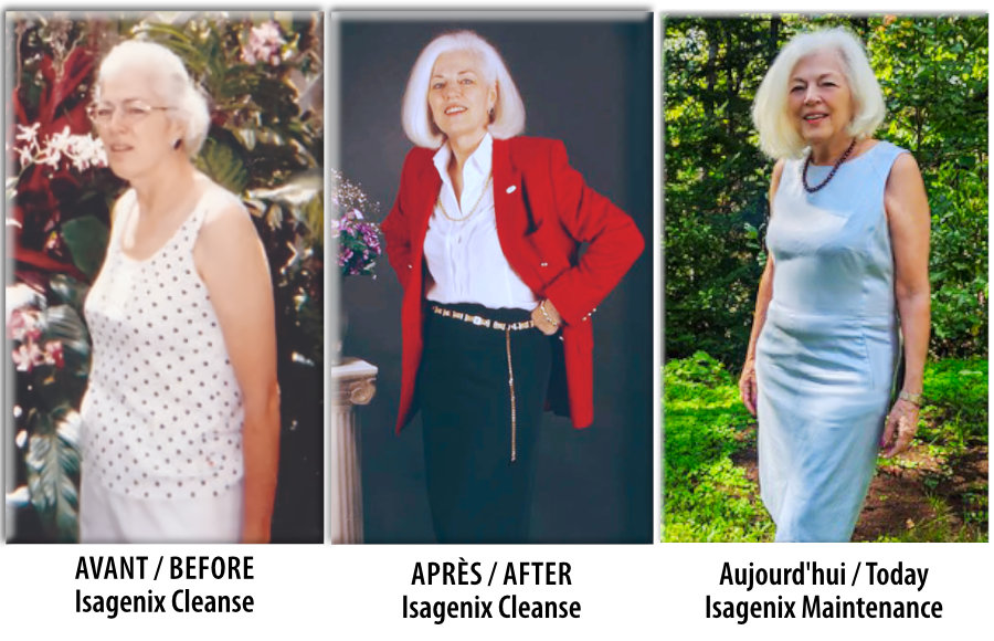 Gisele BeforeAfterToday